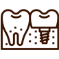 Two stylized teeth with gum line above dental treatment tools in clinical setting.